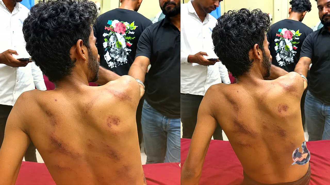 Biaora Youth Lured via Fake Social Media Account and Thrashed with Belts and Pipes
